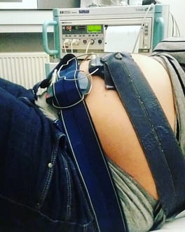 Via de monitor werd de hartslag van de baby opgevolgd
